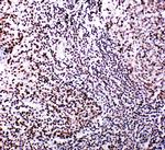 B-Myb Antibody in Immunohistochemistry (Paraffin) (IHC (P))
