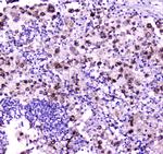 NPC2 Antibody in Immunohistochemistry (Paraffin) (IHC (P))