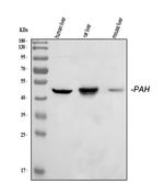 PAH Antibody in Western Blot (WB)