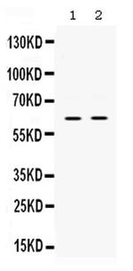 PAK3 Antibody in Western Blot (WB)