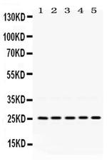 PGRMC1 Antibody in Western Blot (WB)