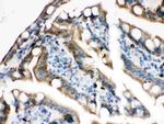 Plectin Antibody in Immunohistochemistry (Paraffin) (IHC (P))