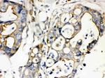 Plectin Antibody in Immunohistochemistry (Paraffin) (IHC (P))