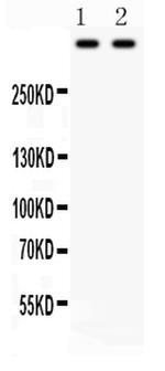 Plectin Antibody in Western Blot (WB)