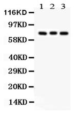 PKC beta-1 Antibody in Western Blot (WB)