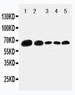 Paxillin Antibody in Western Blot (WB)