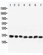 RAB9 Antibody in Western Blot (WB)