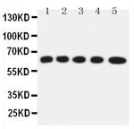 SLC22A5 Antibody in Western Blot (WB)