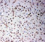 SMAD4 Antibody in Immunohistochemistry (Paraffin) (IHC (P))