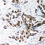 SMAD4 Antibody in Immunohistochemistry (Paraffin) (IHC (P))