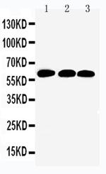 SMAD4 Antibody in Western Blot (WB)