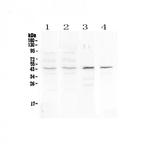 SP6 Antibody in Western Blot (WB)