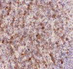 CD43 Antibody in Immunohistochemistry (Paraffin) (IHC (P))