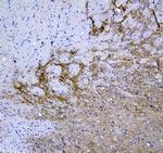 Synaptotagmin 1 Antibody in Immunohistochemistry (Paraffin) (IHC (P))