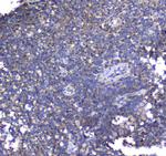 Synaptotagmin 1 Antibody in Immunohistochemistry (Paraffin) (IHC (P))