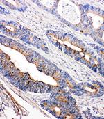 TEC Antibody in Immunohistochemistry (Paraffin) (IHC (P))