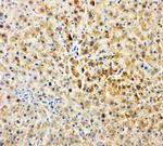 TEC Antibody in Immunohistochemistry (Paraffin) (IHC (P))