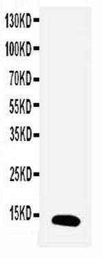 TFF1 Antibody in Western Blot (WB)