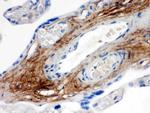 TNXB Antibody in Immunohistochemistry (Paraffin) (IHC (P))