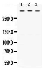 TNXB Antibody in Western Blot (WB)