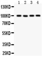 TRPC7 Antibody in Western Blot (WB)