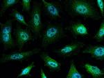 c-Abl Antibody in Immunocytochemistry (ICC/IF)