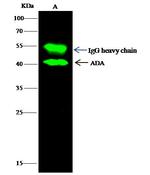 Adenosine Deaminase Antibody in Immunoprecipitation (IP)