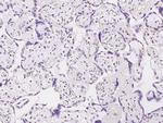 APE1 Antibody in Immunohistochemistry (Paraffin) (IHC (P))