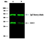 Carbonic Anhydrase XIII Antibody in Immunoprecipitation (IP)