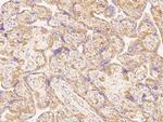 B7-H3 Antibody in Immunohistochemistry (Paraffin) (IHC (P))