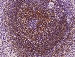 CD21 Antibody in Immunohistochemistry (Paraffin) (IHC (P))