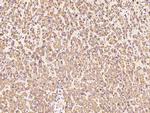 ENPP2 Antibody in Immunohistochemistry (Paraffin) (IHC (P))