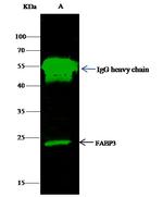 FABP3 Antibody in Immunoprecipitation (IP)