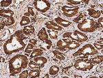 GALE Antibody in Immunohistochemistry (Paraffin) (IHC (P))