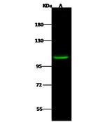 HDAC7 Antibody in Western Blot (WB)