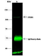 ITGB1 Antibody in Immunoprecipitation (IP)