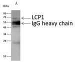 L-Plastin Antibody in Immunoprecipitation (IP)