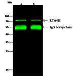 LTA4H Antibody in Immunoprecipitation (IP)