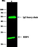 RBP4 Antibody in Immunoprecipitation (IP)