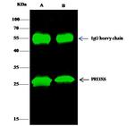 PRDX6 Antibody in Immunoprecipitation (IP)