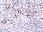 REG3A Antibody in Immunohistochemistry (Paraffin) (IHC (P))