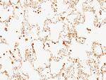 C1 inhibitor Antibody in Immunohistochemistry (Paraffin) (IHC (P))