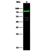 C1 inhibitor Antibody in Western Blot (WB)