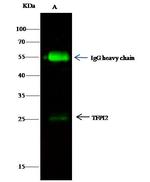 TFPI2 Antibody in Immunoprecipitation (IP)