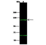 Thyroid Peroxidase Antibody in Western Blot (WB)