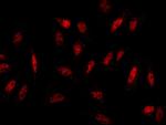 Histone H2A.Z Antibody in Immunocytochemistry (ICC/IF)