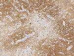 LRRTM2 Antibody in Immunohistochemistry (Paraffin) (IHC (P))