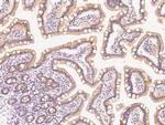 PIK3R2 Antibody in Immunohistochemistry (Paraffin) (IHC (P))