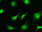 RAD51 Antibody in Immunocytochemistry (ICC/IF)