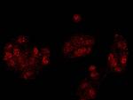 SMURF2 Antibody in Immunocytochemistry (ICC/IF)